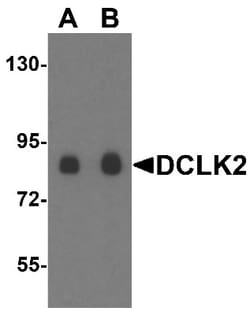 DCAMKL2 Antibody - BSA Free, Novus Biologicals 0.1mg; Unlabeled:Antibodies,